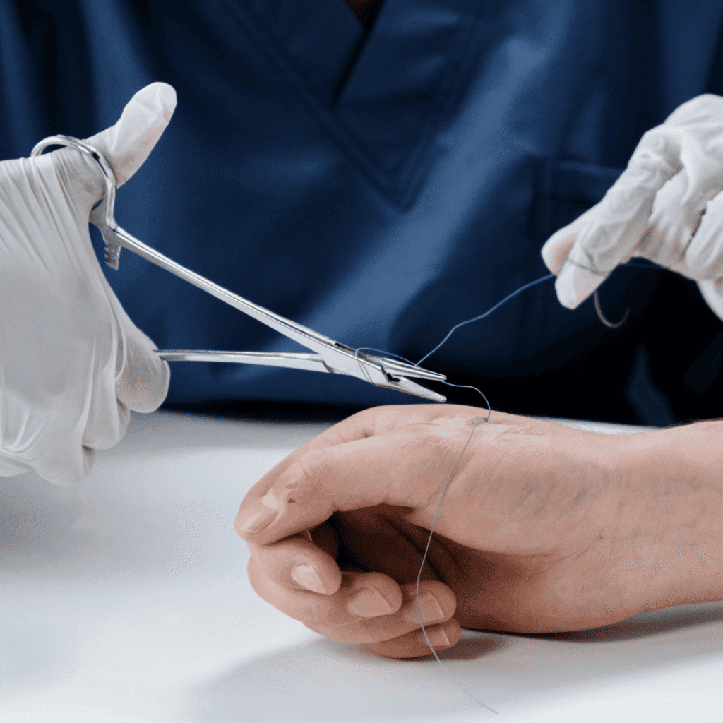 Čas na zašití rány