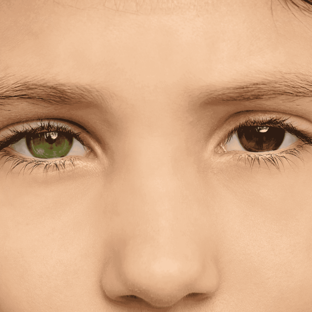 Jak souvisí heterochromie s nutností nosit brýle?